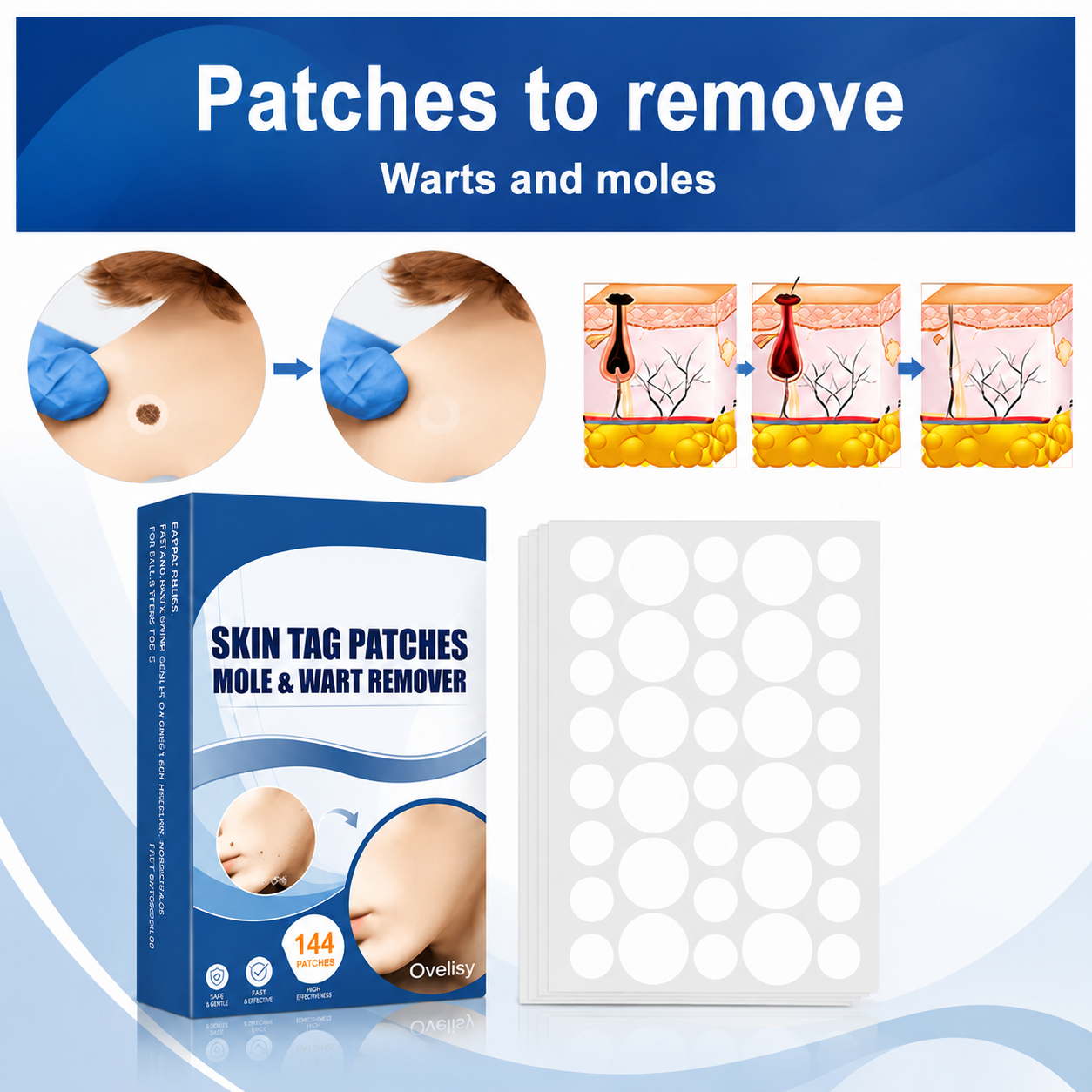 Ovelisy® Skin tag patches mole & wart remover