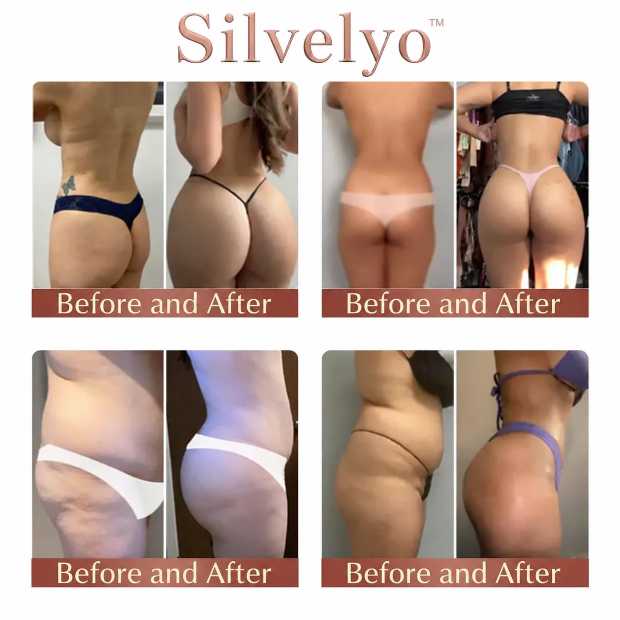 💥Selling out soon🔥-Ovelisy™ CurveSculpt Micro-Patch ✦ Sculpt • Firm • Smooth Lower Body Curves ✦ Micro-Needle Infusion System