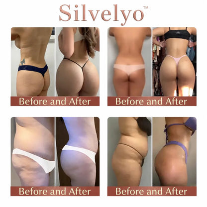 💥Selling out soon🔥-Ovelisy™ CurveSculpt Micro-Patch ✦ Sculpt • Firm • Smooth Lower Body Curves ✦ Micro-Needle Infusion System