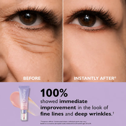 💥LAST DAY SALE-60% OFF- Ovelisy Eye Bag Instant Eraser, Tightens, Firms, & Blurs Wrinkles