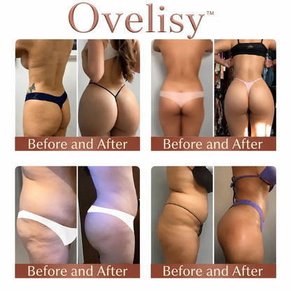 💥Selling out soon🔥-Ovelisy™ CurveSculpt Micro-Patch ✦ Sculpt • Firm • Smooth Lower Body Curves ✦ Micro-Needle Infusion System