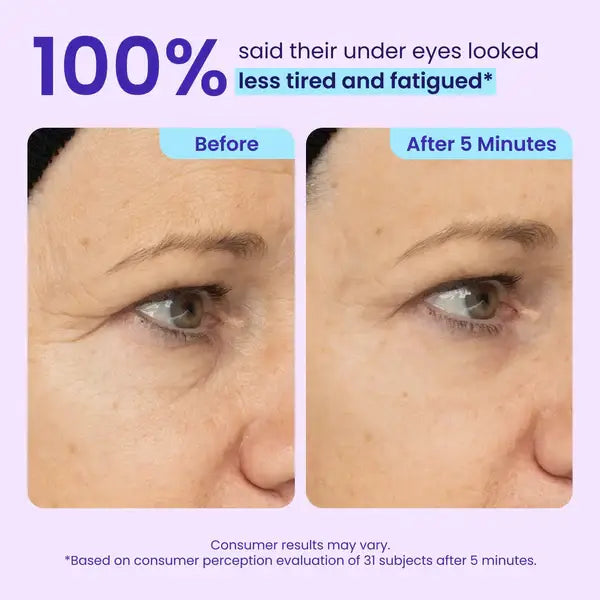💥LAST DAY SALE-60% OFF- Ovelisy Eye Bag Instant Eraser, Tightens, Firms, & Blurs Wrinkles