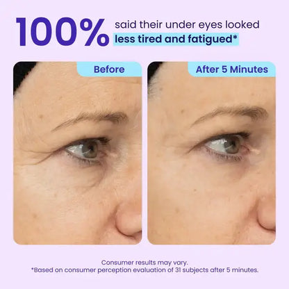 💥LAST DAY SALE-60% OFF- Ovelisy Eye Bag Instant Eraser, Tightens, Firms, & Blurs Wrinkles