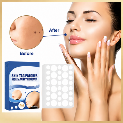 Ovelisy® Skin tag patches mole & wart remover
