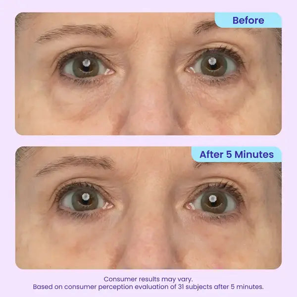 💥LAST DAY SALE-60% OFF- Ovelisy Eye Bag Instant Eraser, Tightens, Firms, & Blurs Wrinkles