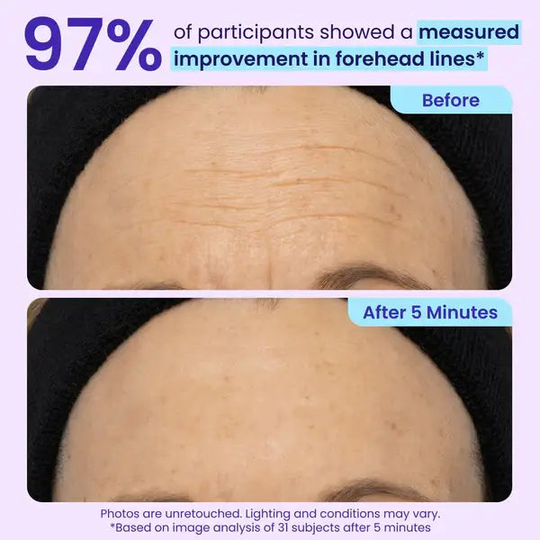 💥LAST DAY SALE-60% OFF- Ovelisy Eye Bag Instant Eraser, Tightens, Firms, & Blurs Wrinkles