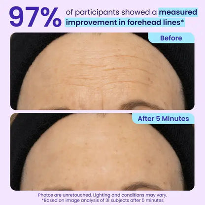 💥LAST DAY SALE-60% OFF- Ovelisy Eye Bag Instant Eraser, Tightens, Firms, & Blurs Wrinkles