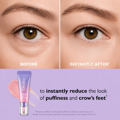 💥LAST DAY SALE-60% OFF- Ovelisy Eye Bag Instant Eraser, Tightens, Firms, & Blurs Wrinkles