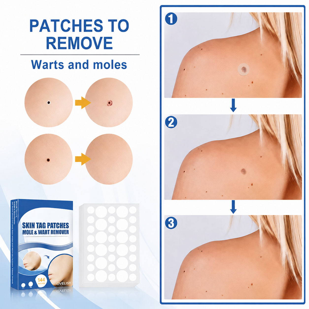 Ovelisy® Skin tag patches mole & wart remover