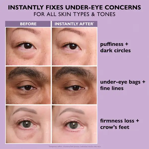 💥LAST DAY SALE-60% OFF- Ovelisy Eye Bag Instant Eraser, Tightens, Firms, & Blurs Wrinkles