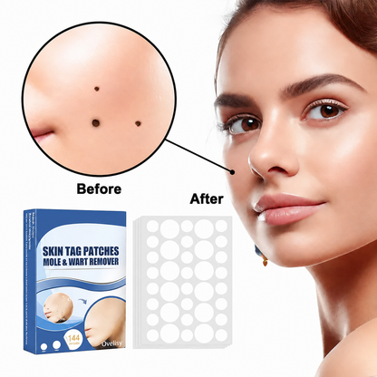 Ovelisy® Skin tag patches mole & wart remover