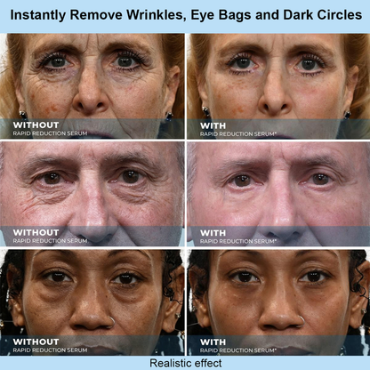 Ovelisy™ Instant Face Temporary Tightener – Instant visible results in 60 seconds