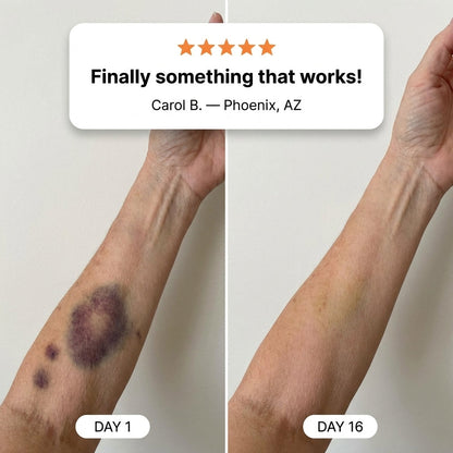 💥110K+ SOLD💕- OVELISY® Bruise Repair & Skin-Strengthening Cream
