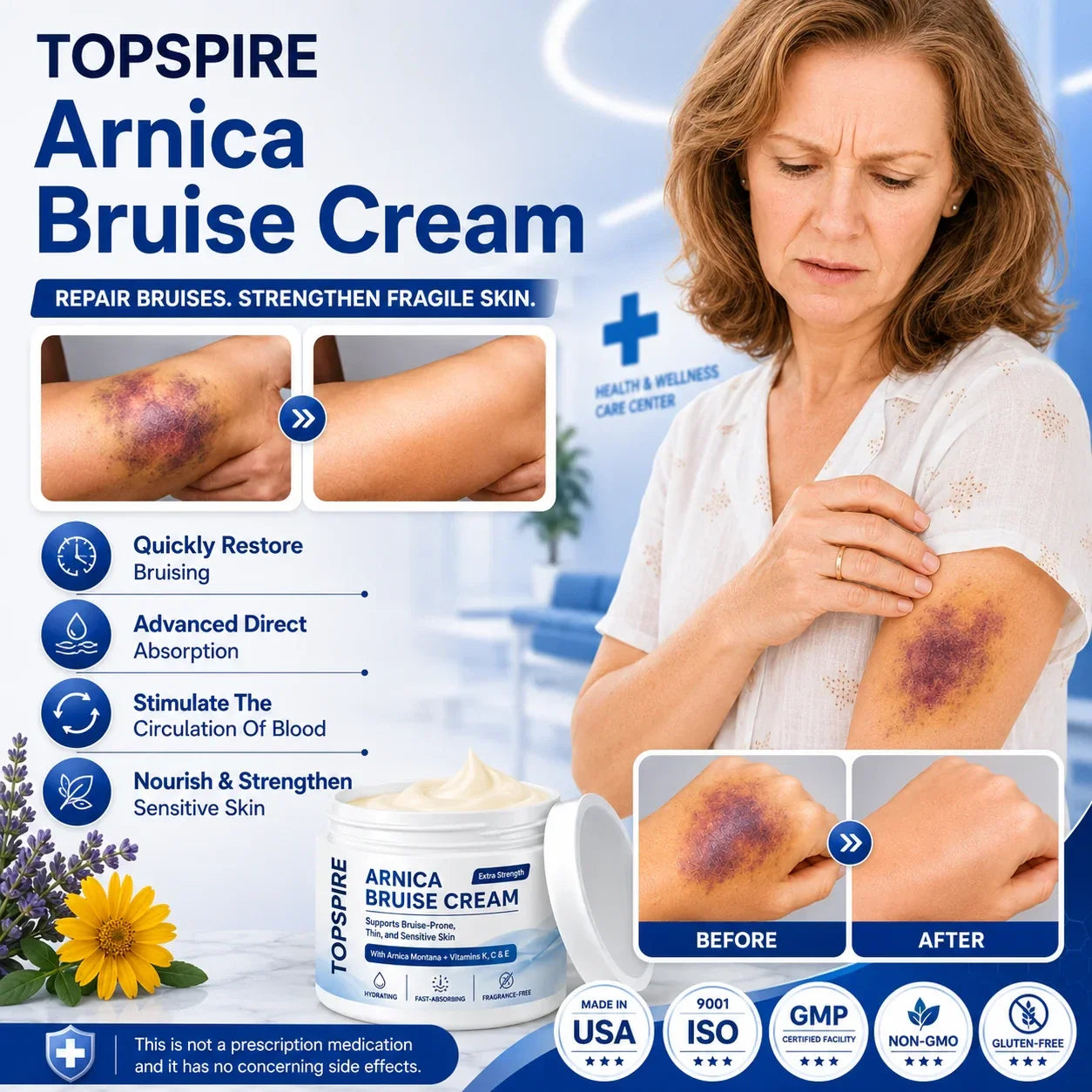 💥75K+ SOLD💕 TOPSPIRE® Arnica Bruise Cream - Repair Bruises & Strengthen Fragile Skin